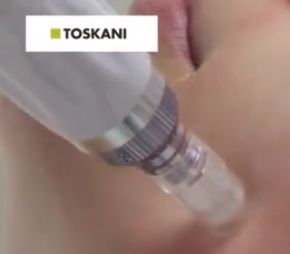TOSKANI特思嘉微针操作.mp4